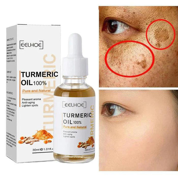 Turmeric™ Óleo Anti-Idade Removedor de Manchas (Até 33% De Desconto)