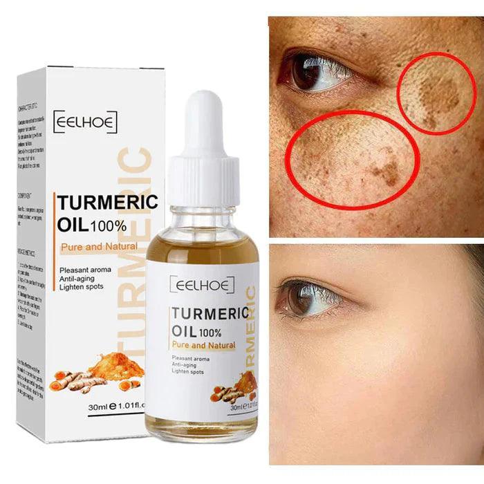Turmeric™ Óleo Anti-Idade Removedor de Manchas (Até 33% De Desconto)